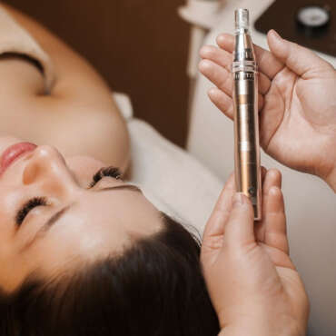 Microneedling